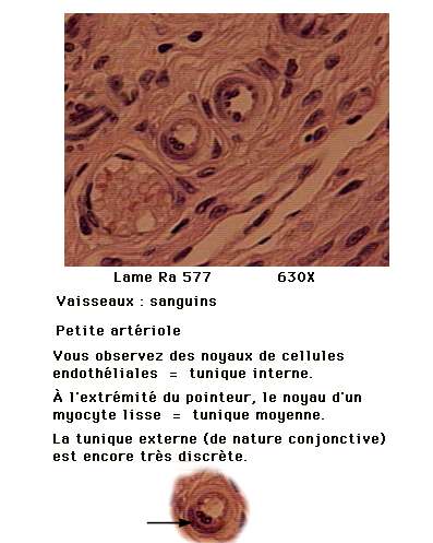 cardio 1_2.jpg (30112 octets)