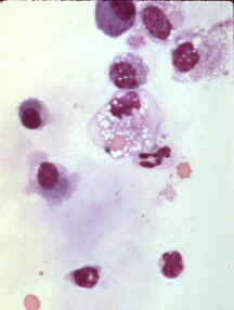 cyto-11.jpg (6056 bytes)