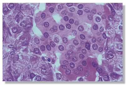 pancreas1.jpg (15868 octets)