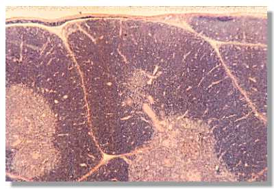 thymus2.jpg (19706 octets)