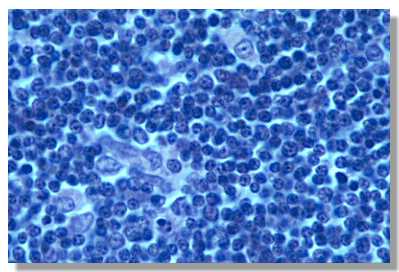 thymus3.jpg (20051 octets)