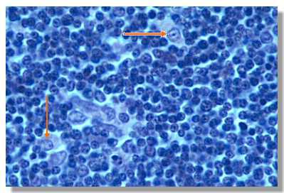 thymus3P.jpg (21510 octets)