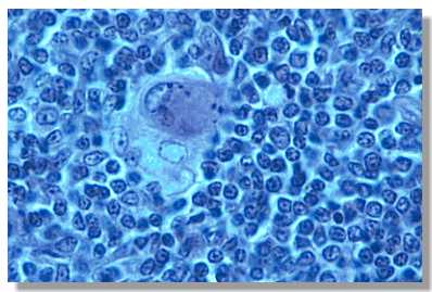 thymus4.jpg (20701 octets)