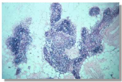 thymus7.jpg (14497 octets)