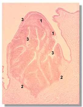 amygdale1P.jpg (10301 octets)