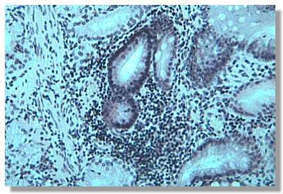 t_dif_1.jpg (26080 octets)