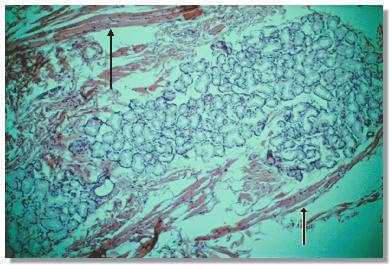 cb6p.jpg (22867 octets)
