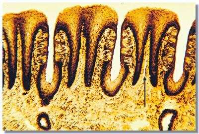 cb9p.jpg (27546 octets)