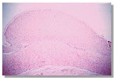 Gi3.jpg (10369 octets)