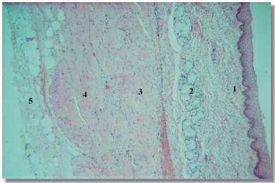 oeso1p.jpg (12732 octets)
