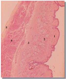 oeso2p.jpg (9063 octets)