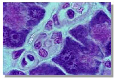 PANCREA3.JPG (11597 octets)