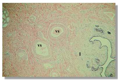 rf3_3P.jpg (14716 octets)