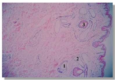 rf3_4P.jpg (11035 octets)