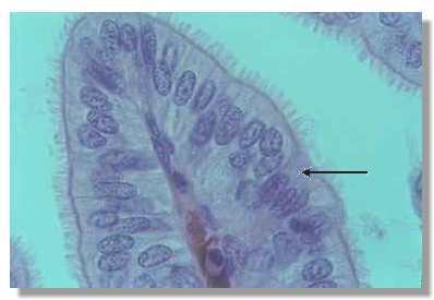 rf2_2P.jpg (10420 octets)