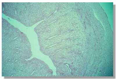 rf2_5.jpg (12344 octets)