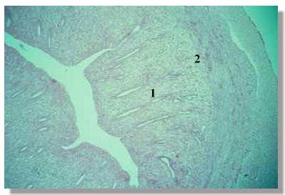 rf2_5P.jpg (12366 octets)