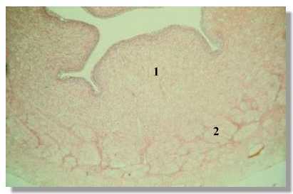rf2_7P.jpg (8935 octets)