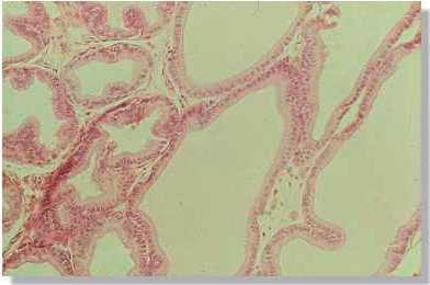 rm3_001.jpg (10888 octets)