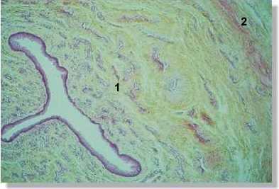 rm3_002P.jpg (14079 octets)