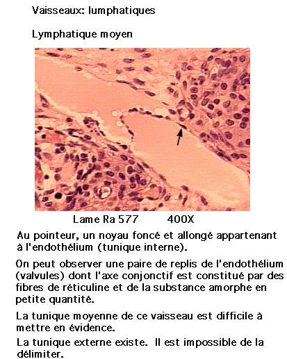 cardio 1_18.jpg (44425 octets)