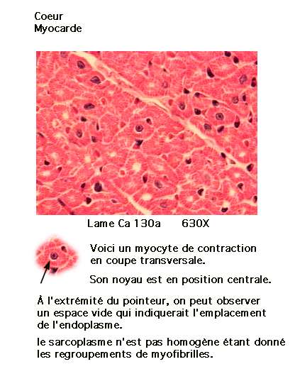 cardio 1_23.jpg (36324 octets)