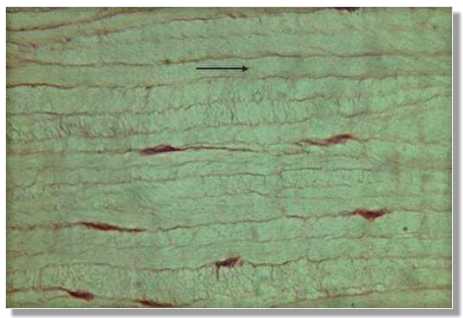 tc15p.jpg (15059 octets)