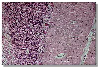 tnerv14p.jpg (25457 octets)