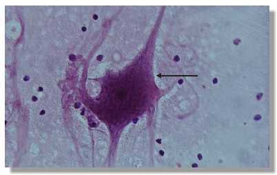 tnerv1p.jpg (9862 octets)