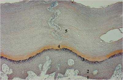 er10p.jpg (13832 octets)